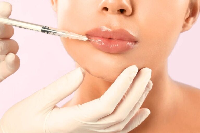 Preenchimento Facial